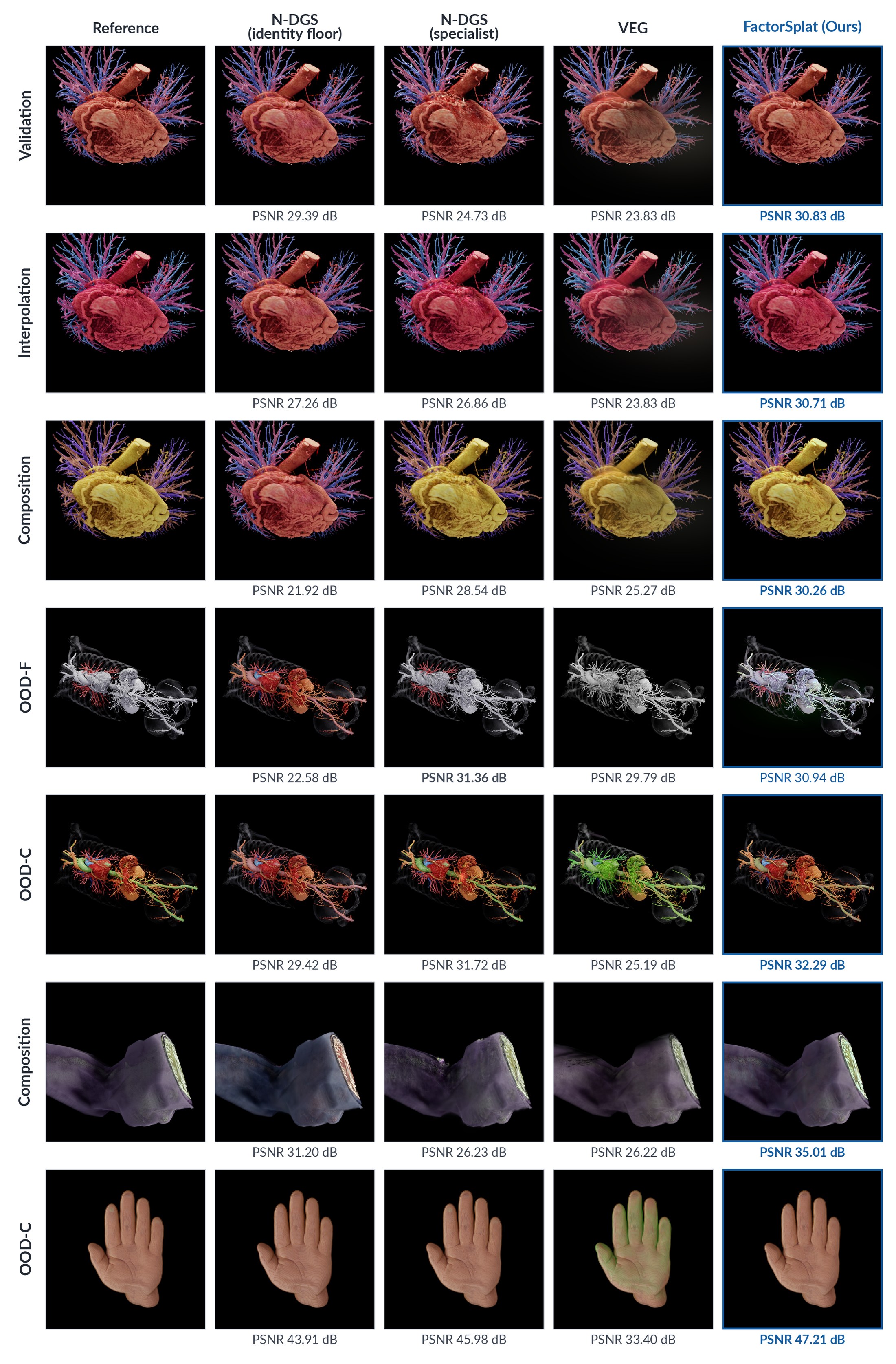 Held-out CT and MR examples: heart, vascular, nose, hand