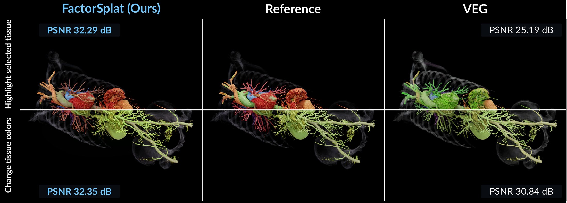 FactorSplat, the path-traced reference, and VEG under two vascular transfer-function edits