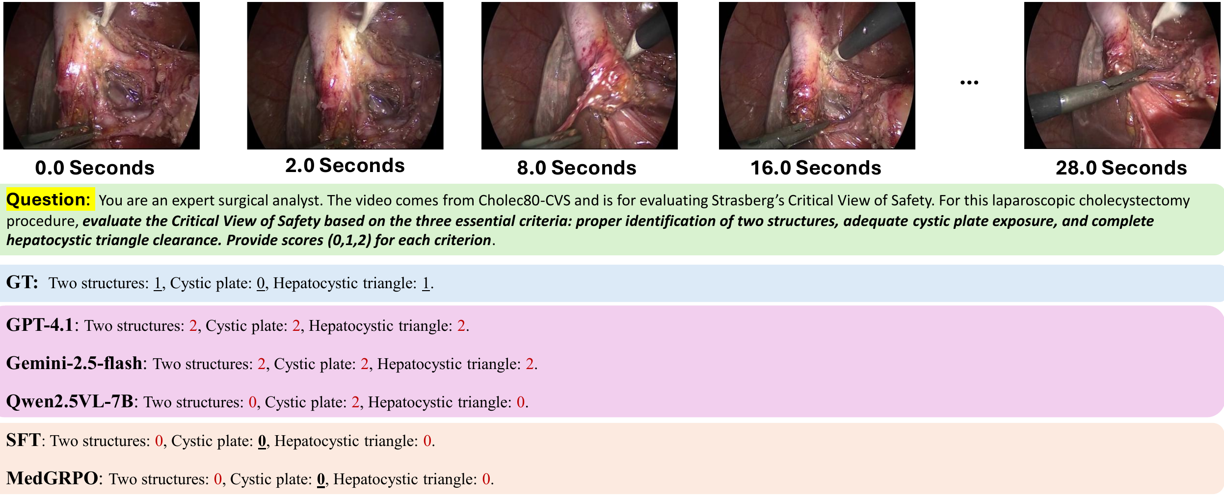 Failure case analysis