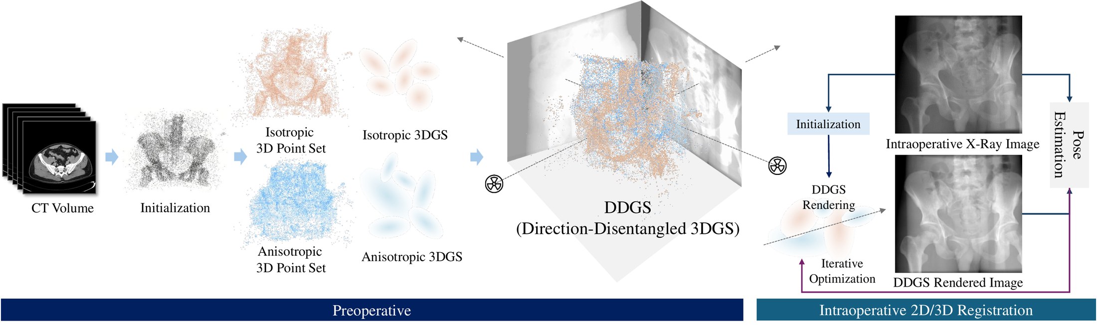 DDGS pipeline: preoperative fitting of isotropic and anisotropic Gaussians from CT, then intraoperative 2D/3D registration