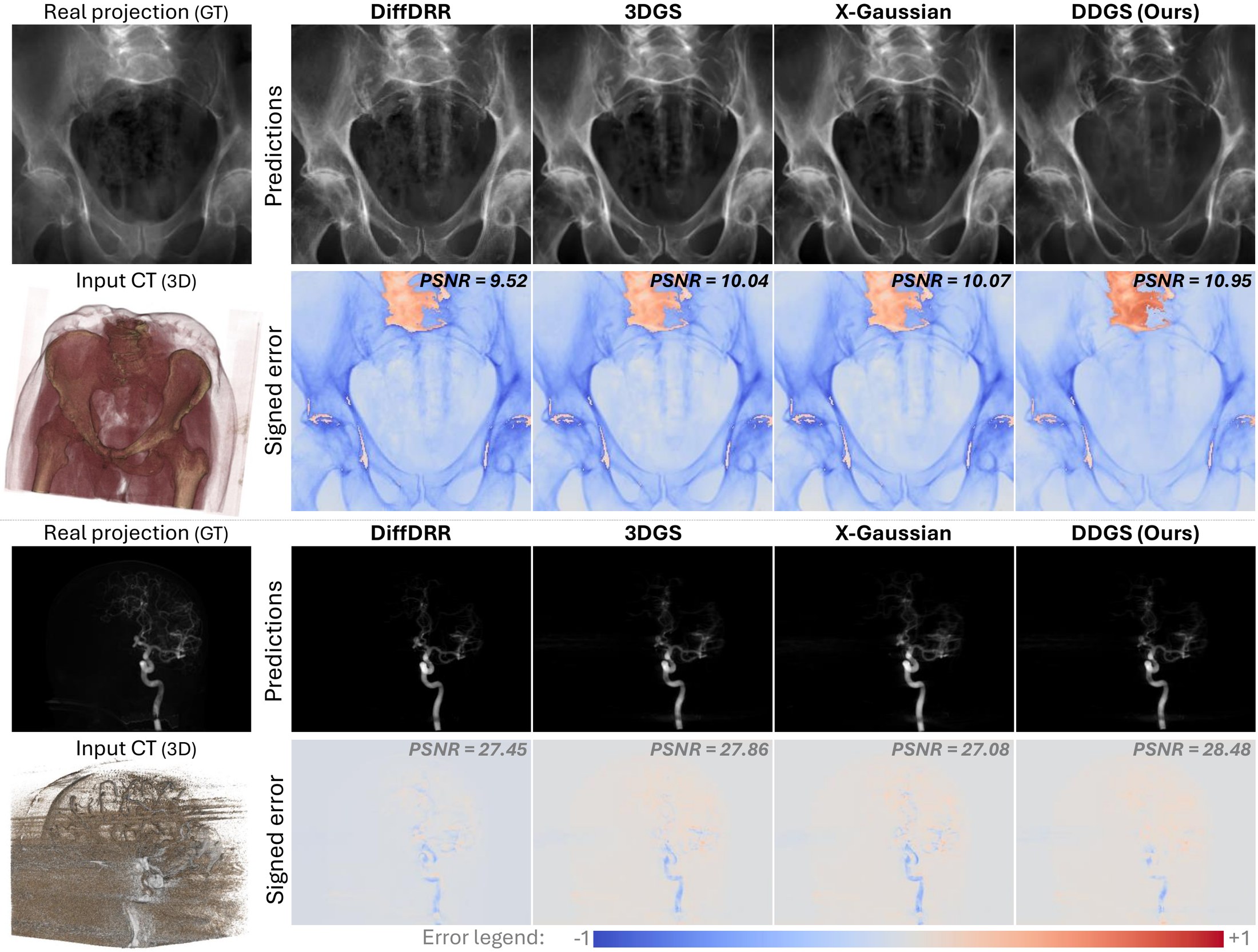 DiffDRR, 3DGS, X-Gaussian and DDGS against real X-ray projections, with signed error maps