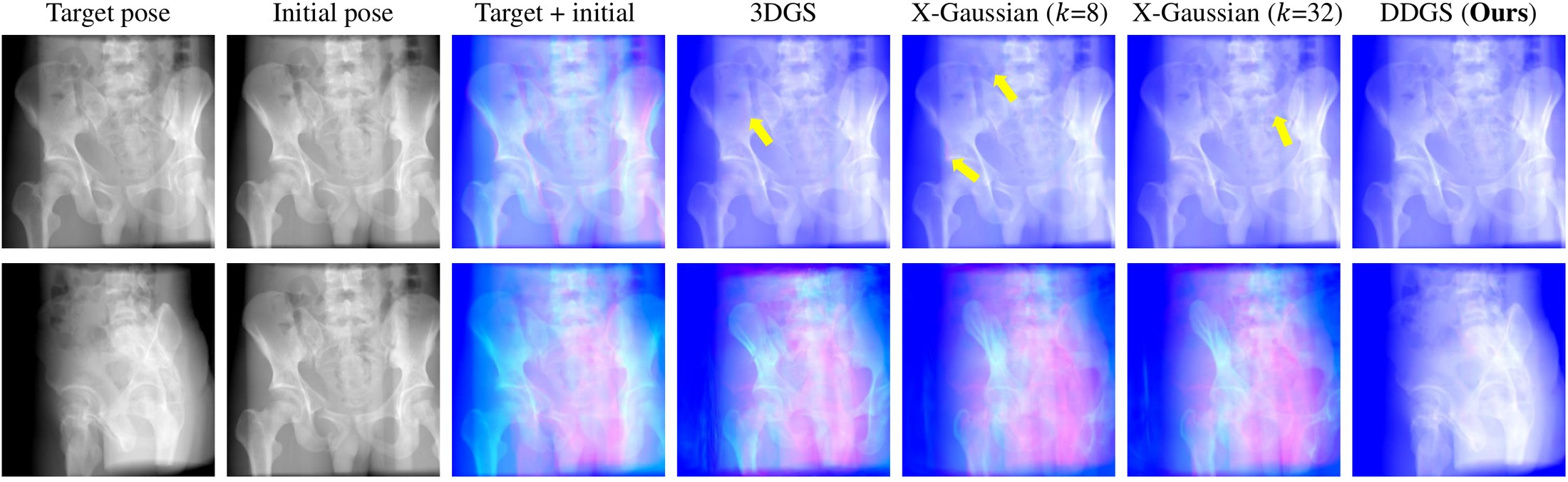 Pose-registration convergence with 3DGS, X-Gaussian and DDGS